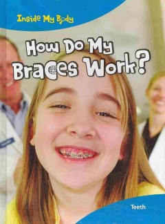 How do my braces work?  Cover Image